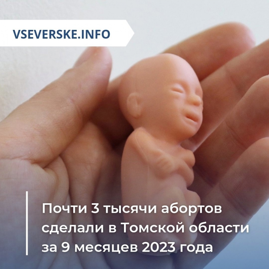 Почти 3 тысячи абортов сделали в Томской области за 9 месяцев 2023 года